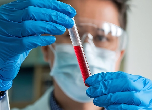 Hemoglobina Glicada HbA1c Bioquímica — CEMED Campina Grande PB