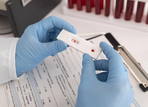 Anti-HCV Hepatite C — CEMED Campina Grande PB