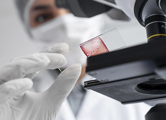 Toxoplasmose IgG IgM — CEMED Campina Grande PB